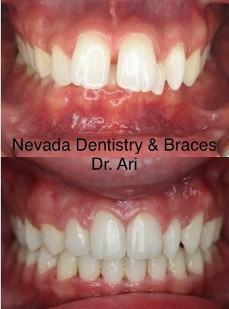 Nevada Dentistry & Braces 3