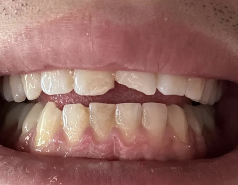 LV Dental 5