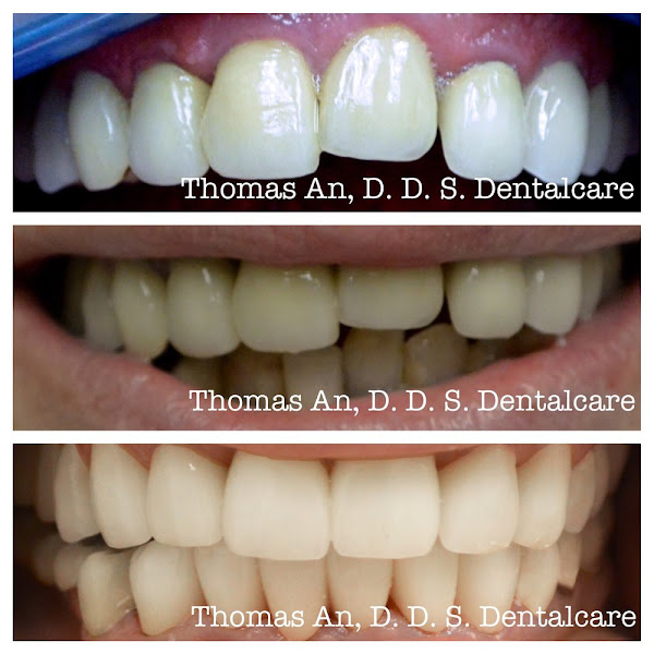 Thomas An, D.D.S. Dentalcare 3