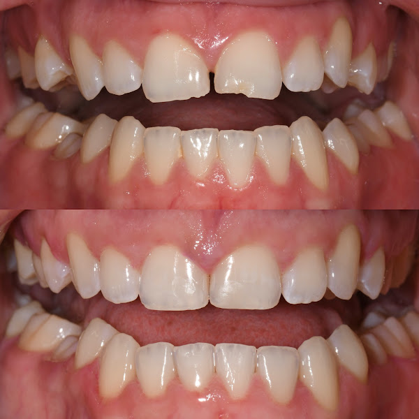 Smile In Style Dentistry | Diem Do, DDS 3