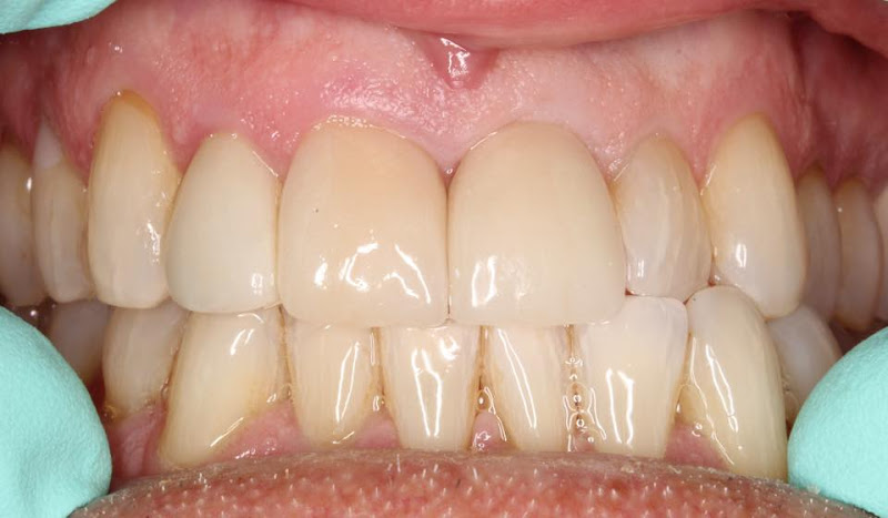 La Mesa Smiles & Implant Dentistry
