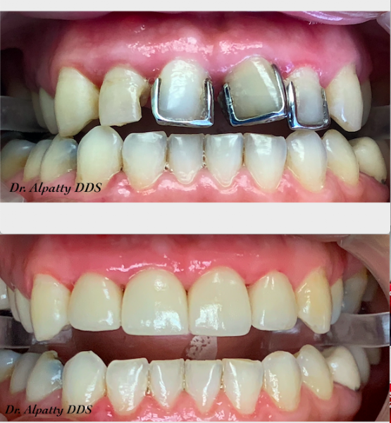 El Cajon Dentistry 2