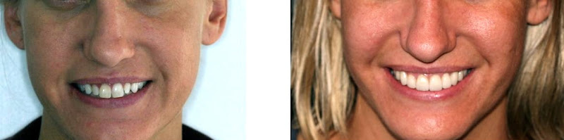 Santee Family Dental Practice Drs. Michael & Devani Brown 4