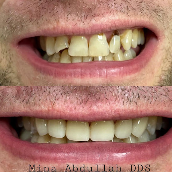Poway Dentistry 5