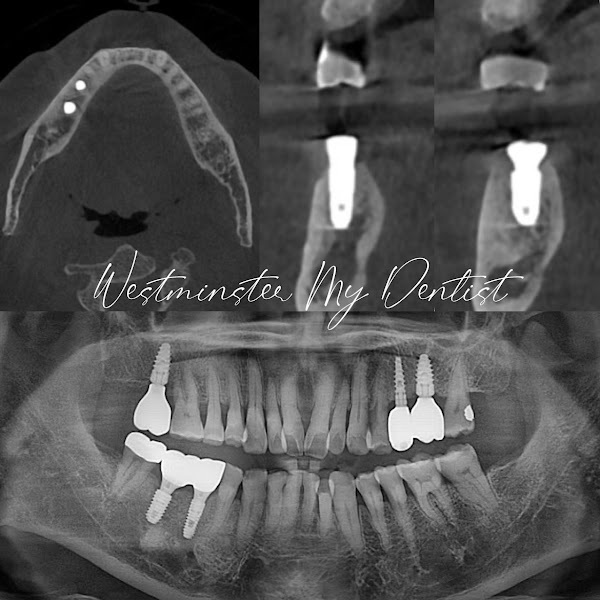 Westminster My Dentist 3