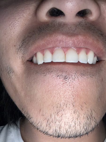 Bolsa Dental 3
