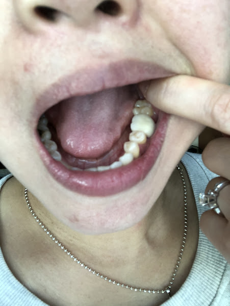 Ace Dental 4