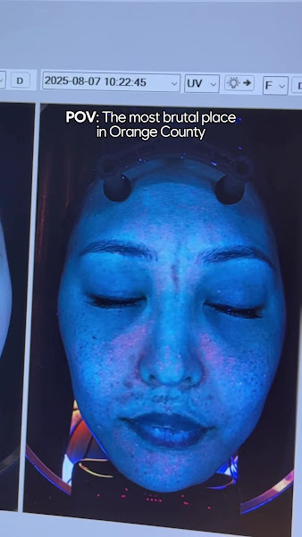MeSO Medspa Newport Beach 2