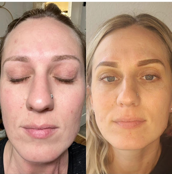 Natural Radiance - Permanent Makeup and Aesthetics 2