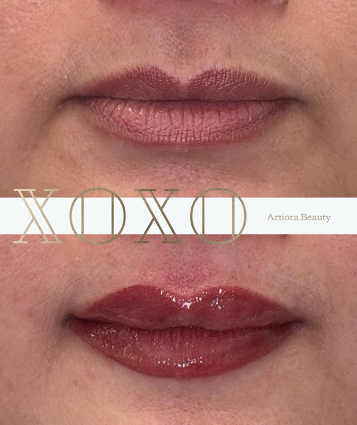 Artiora Beauty 4
