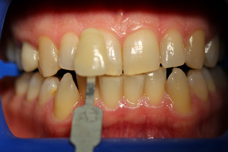 Orange Smile Dentist - Best Dentist in Orange CA 2