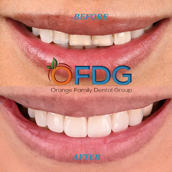 Orange Family Dental Group