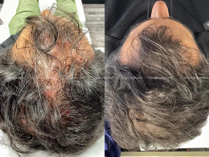 True Dermatology 2