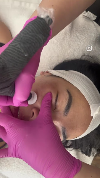 1503 Esthetics 2