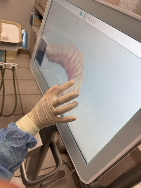 Elite Dental Irvine 2