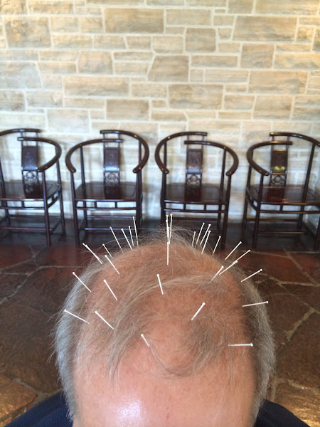 Yu Family Acupuncture Clinic 4
