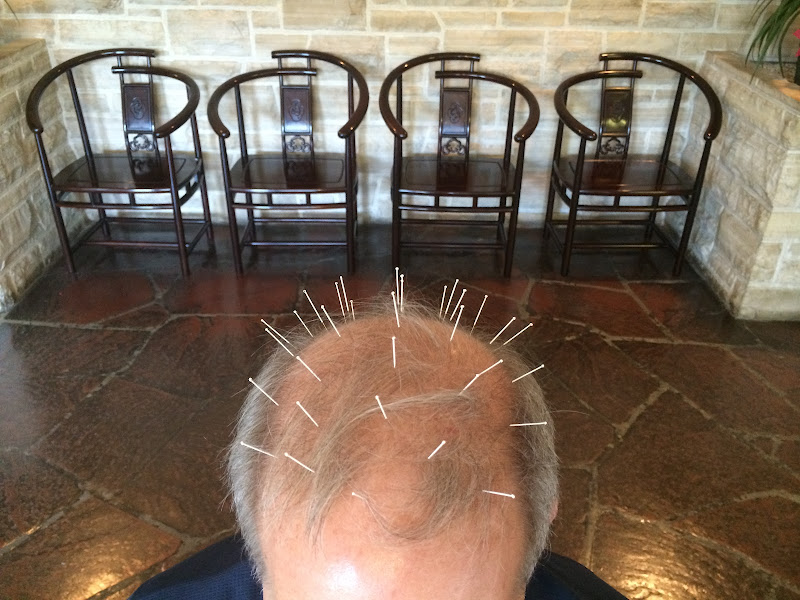 Yu Family Acupuncture Clinic 5