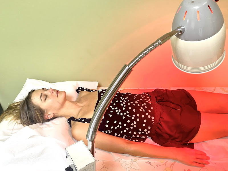 Miracle Acupuncture 2