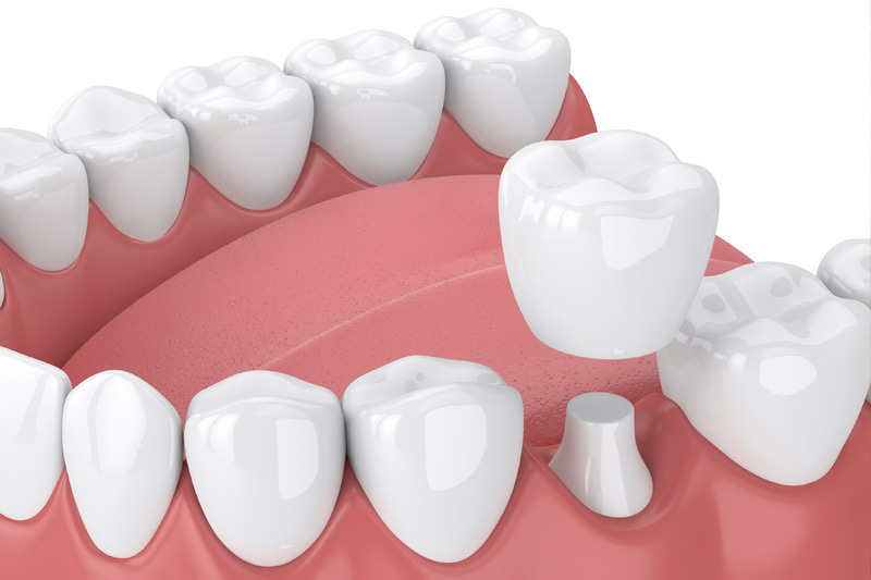 Coast Dental Group - Garden Grove